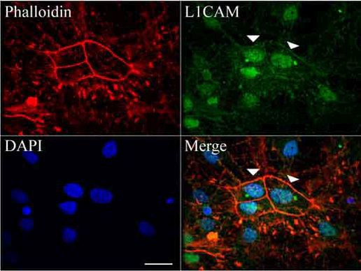 L1CAM Antibody in Immunocytochemistry (ICC/IF)