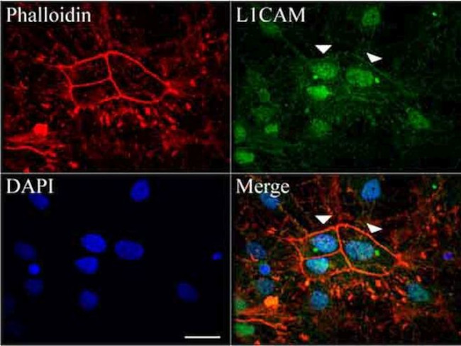 L1CAM Antibody in Immunocytochemistry (ICC/IF)