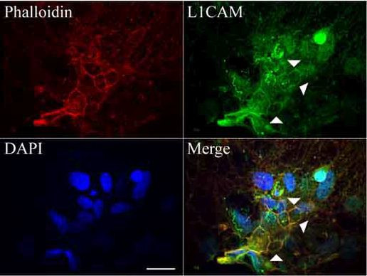 L1CAM Antibody in Immunocytochemistry (ICC/IF)