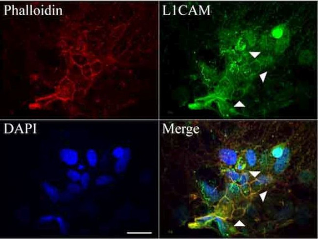 L1CAM Antibody in Immunocytochemistry (ICC/IF)