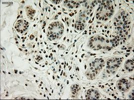 L1CAM Antibody in Immunohistochemistry (Paraffin) (IHC (P))