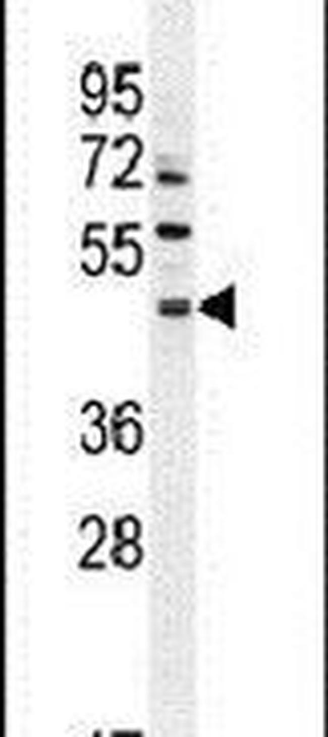 LACE1 Antibody in Western Blot (WB)