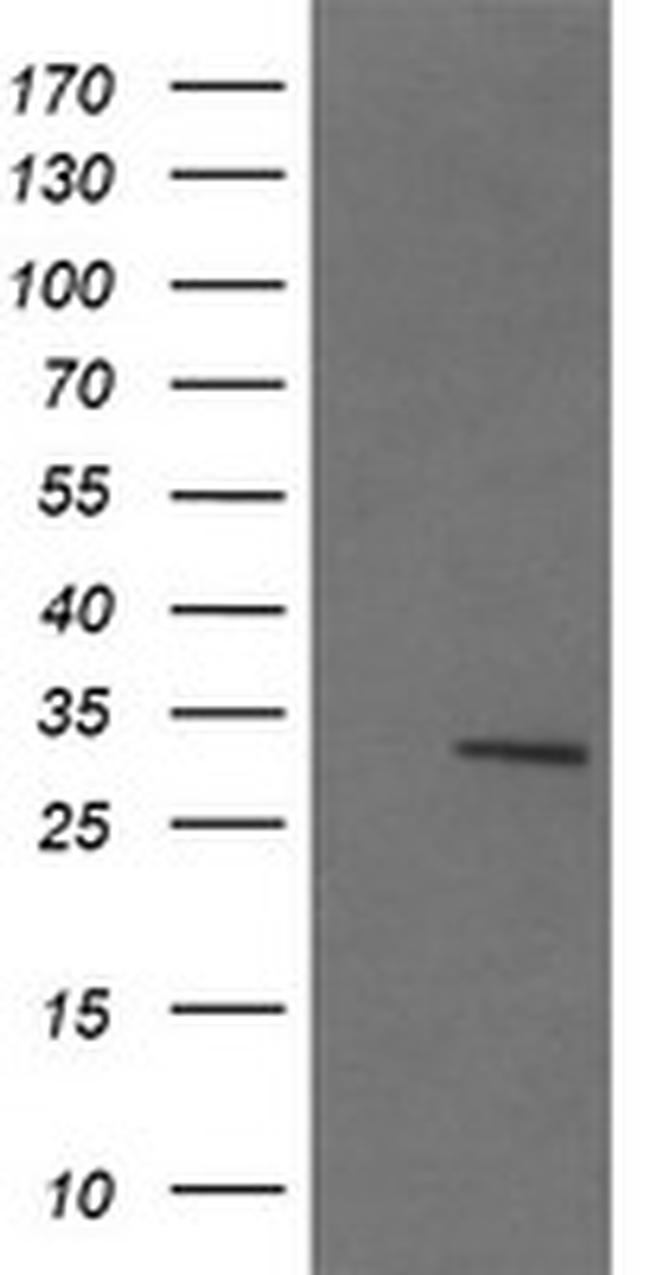 LACTB2 Antibody in Western Blot (WB)