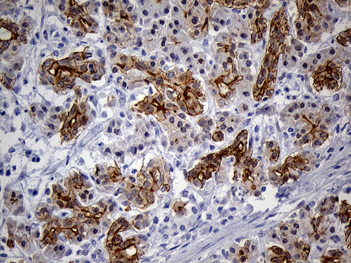 LAD1 Antibody in Immunohistochemistry (Paraffin) (IHC (P))