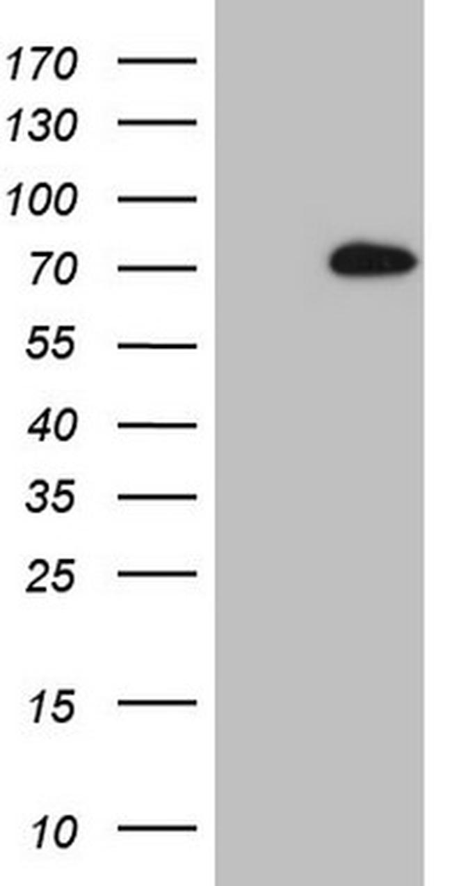 LAG3 Antibody in Western Blot (WB)