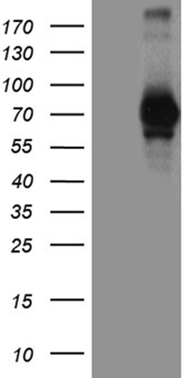 LAG3 Antibody in Western Blot (WB)