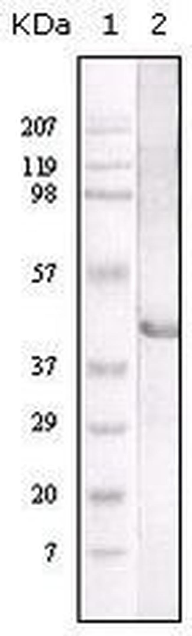 LIPA Antibody in Western Blot (WB)