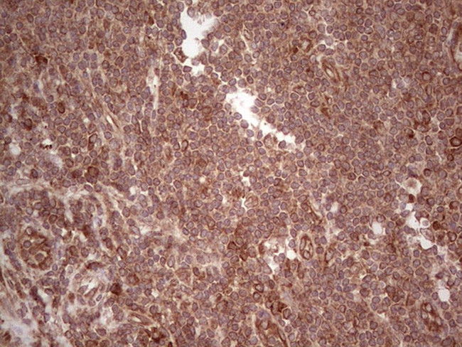LAMB3 Antibody in Immunohistochemistry (Paraffin) (IHC (P))
