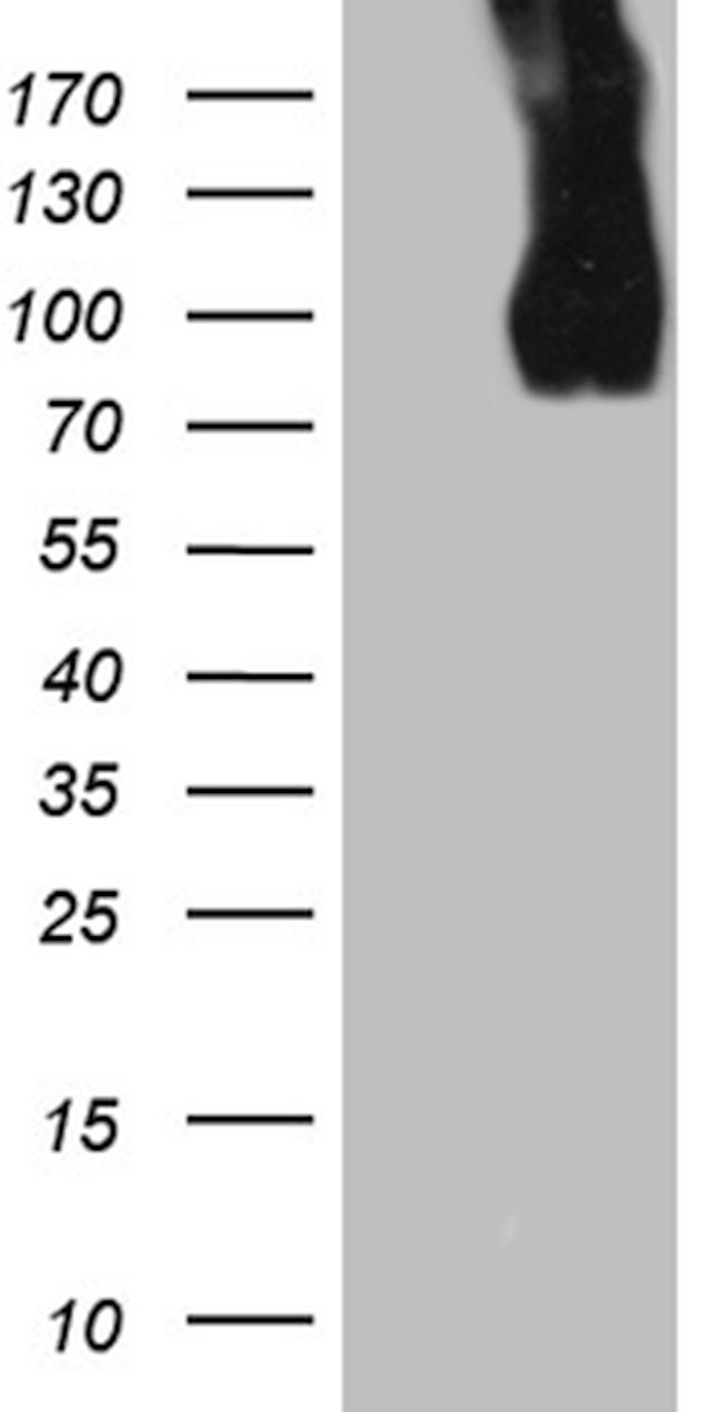 LAMP1 Antibody in Western Blot (WB)