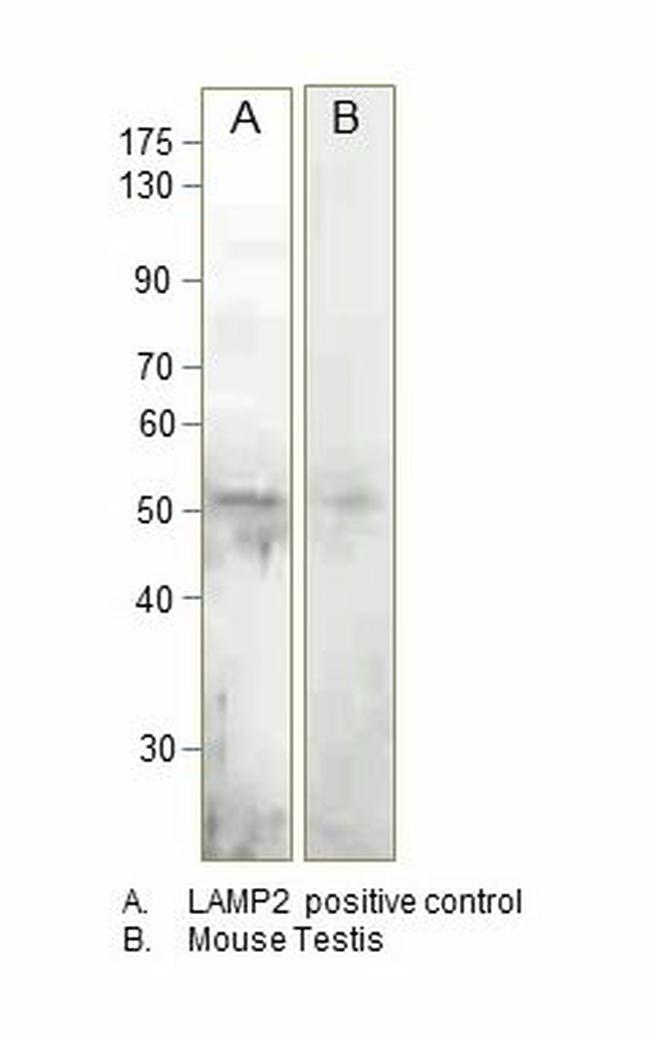 LAMP2 Antibody in Western Blot (WB)