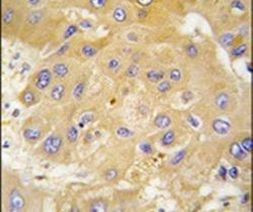 LAP3 Antibody in Immunohistochemistry (IHC)