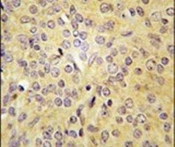 LARS Antibody in Immunohistochemistry (IHC)