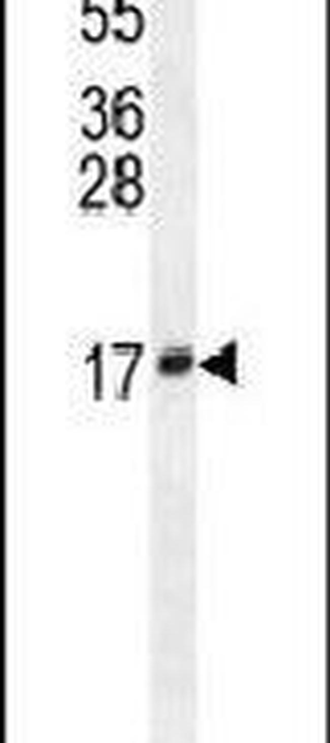LCN10 Antibody in Western Blot (WB)