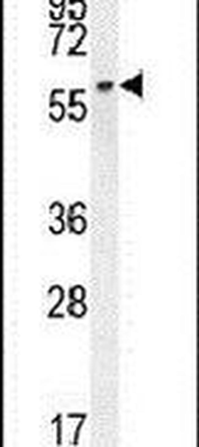 LCOR Antibody in Western Blot (WB)
