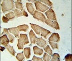 LDHD Antibody in Immunohistochemistry (IHC)