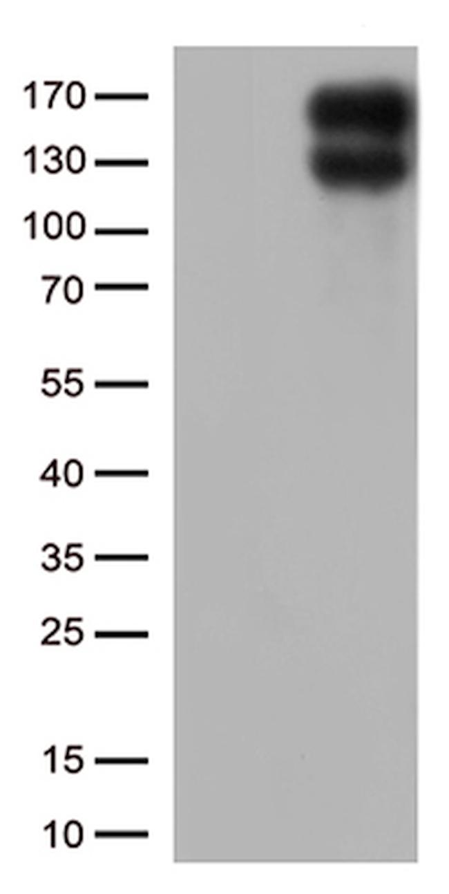LDLR Antibody in Western Blot (WB)