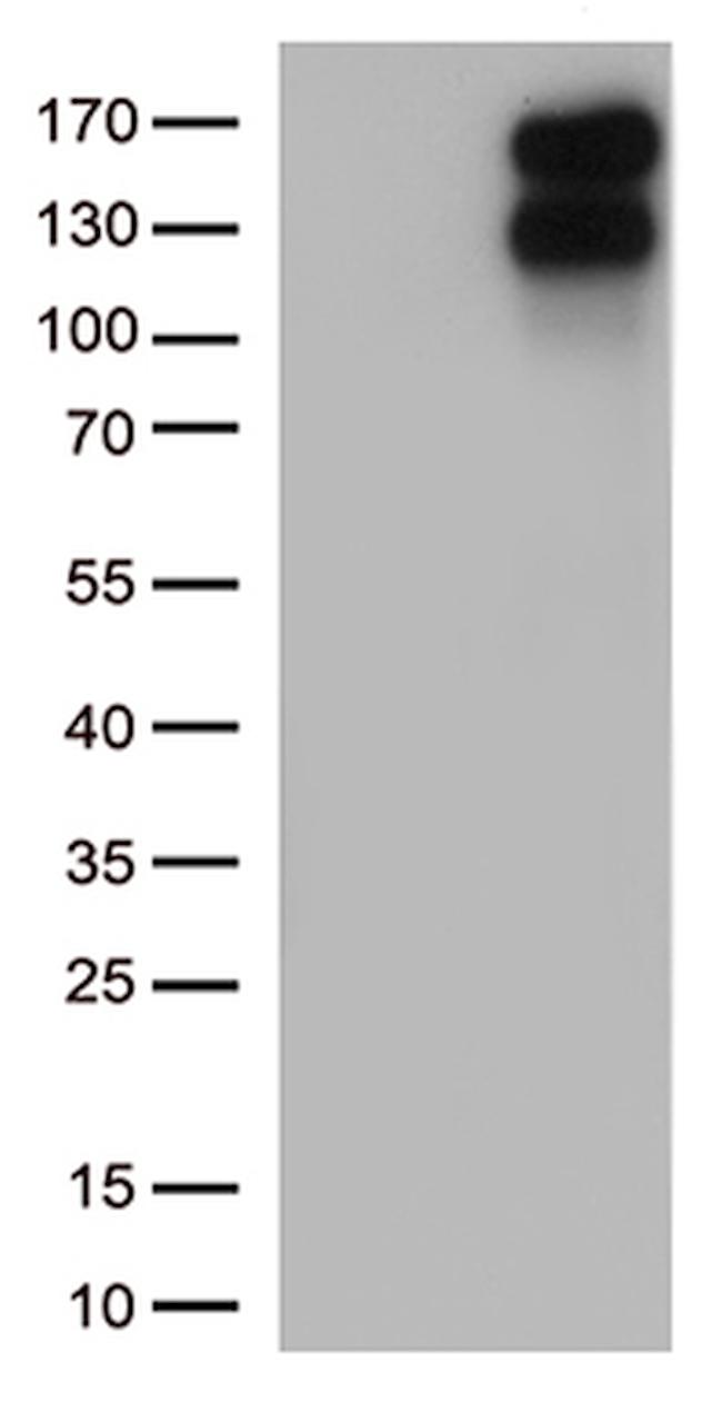 LDLR Antibody in Western Blot (WB)