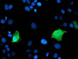 LDLRAP1 Antibody in Immunocytochemistry (ICC/IF)