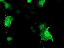 LDLRAP1 Antibody in Immunocytochemistry (ICC/IF)