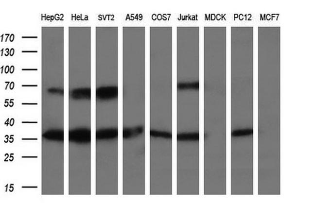 LDLRAP1 Antibody in Western Blot (WB)