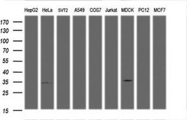 LDLRAP1 Antibody in Western Blot (WB)