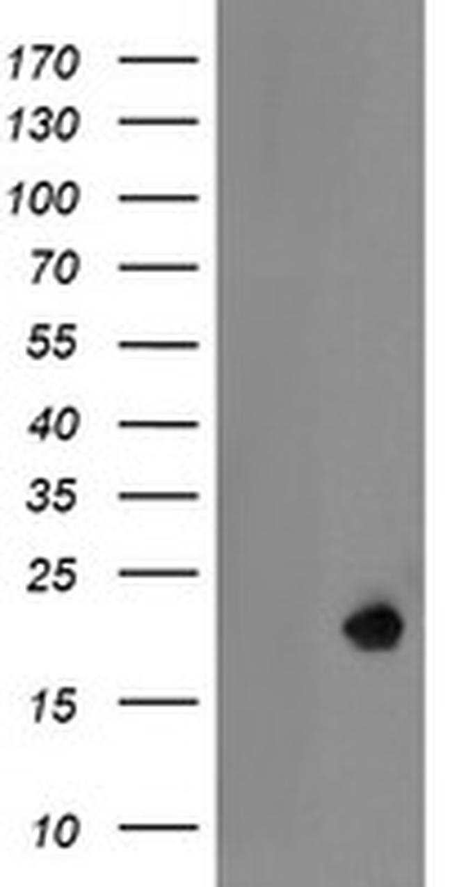 LDOC1 Antibody in Western Blot (WB)