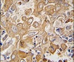 LECT1 Antibody in Immunohistochemistry (IHC)