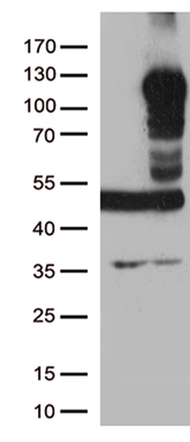 LEMD3 Antibody in Western Blot (WB)