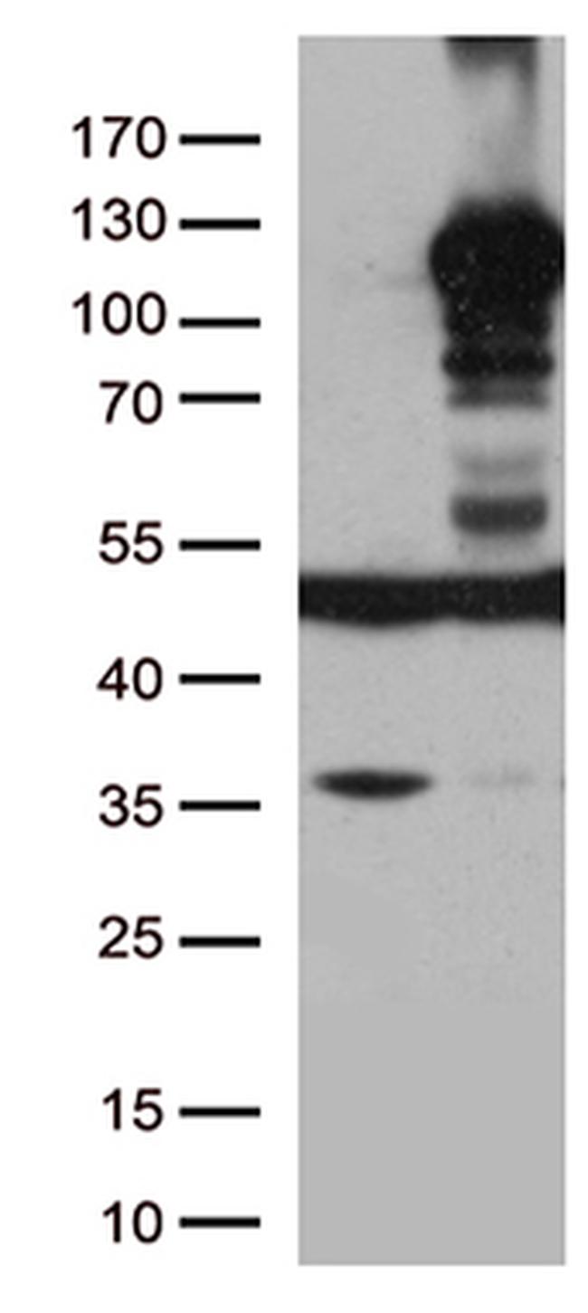 LEMD3 Antibody in Western Blot (WB)