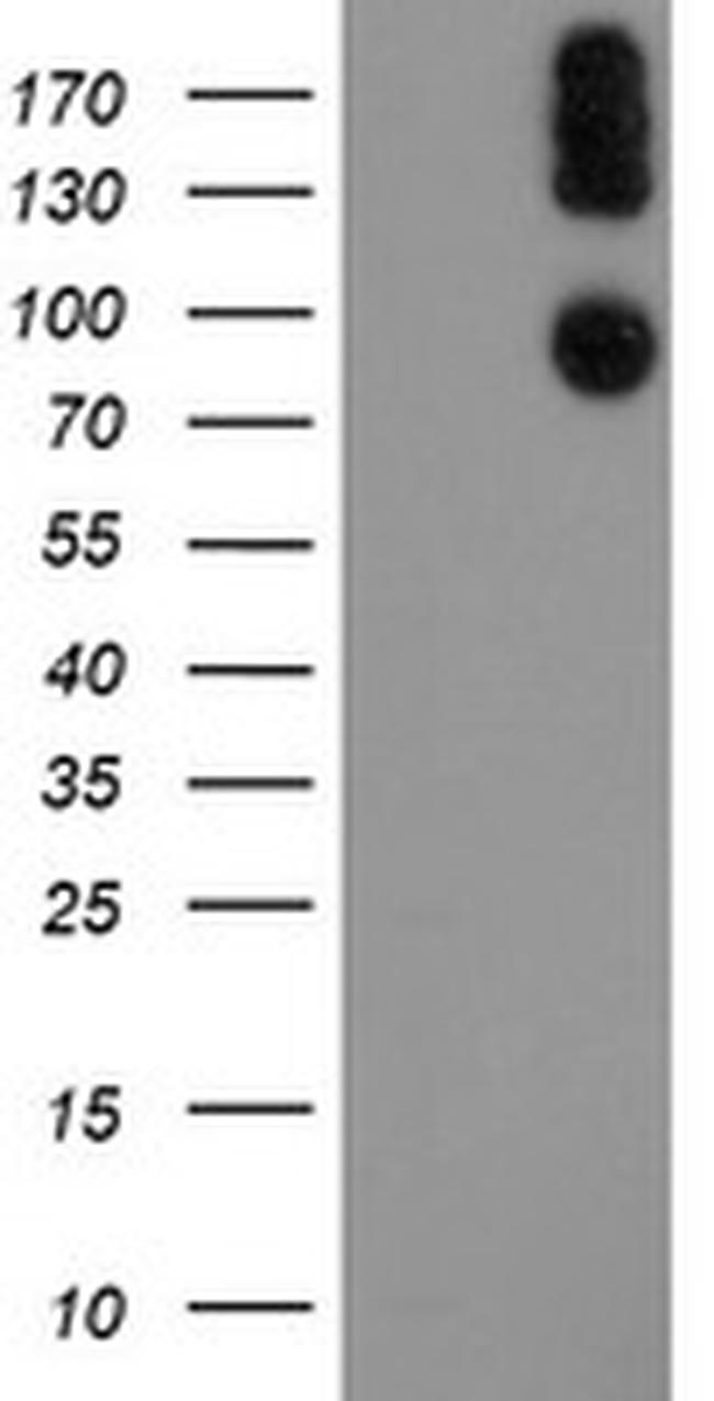 LEPRE1 Antibody in Western Blot (WB)
