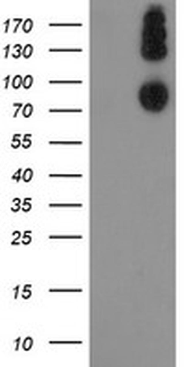 LEPRE1 Antibody in Western Blot (WB)