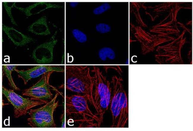Catalase Antibody in Immunocytochemistry (ICC/IF)