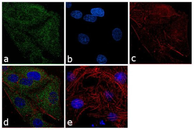 PTP1B Antibody in Immunocytochemistry (ICC/IF)