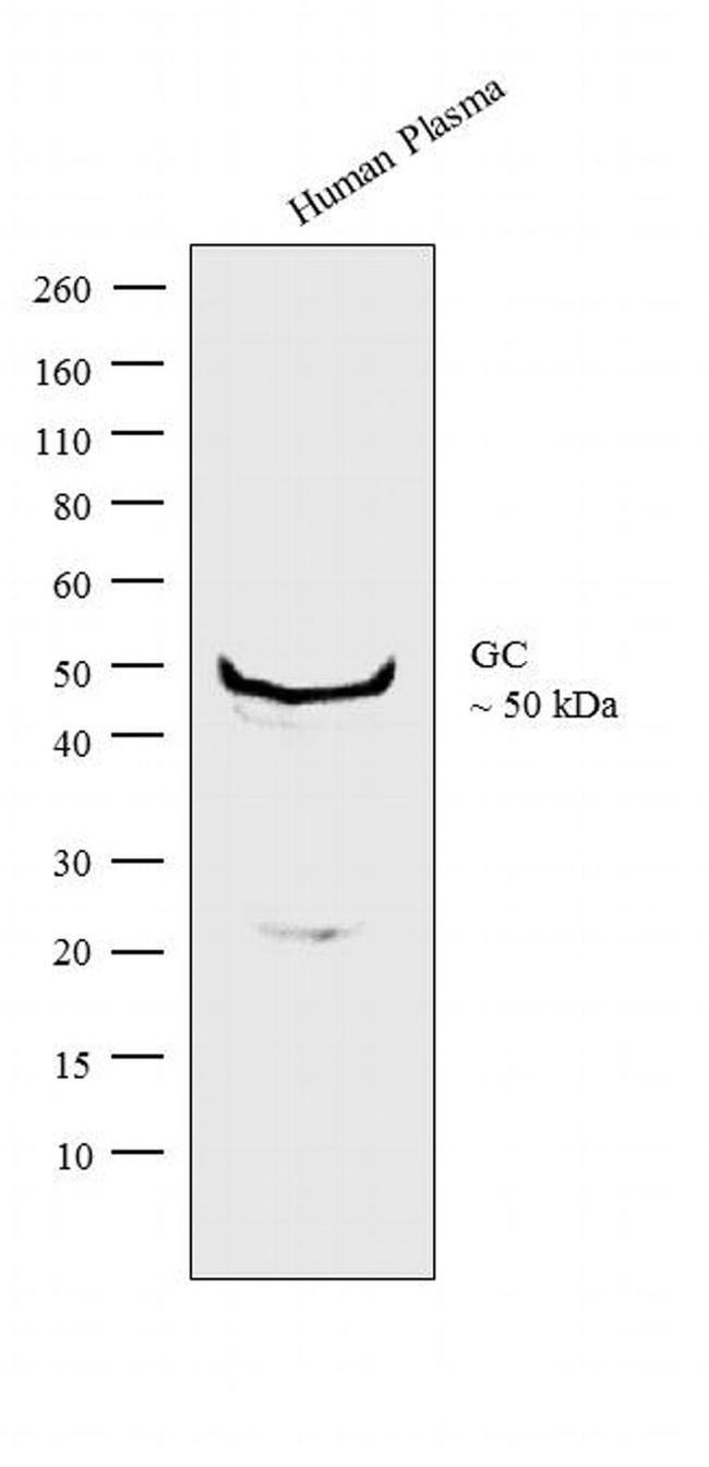GC Antibody in Western Blot (WB)