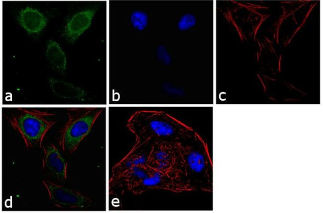 CDK6 Antibody in Immunocytochemistry (ICC/IF)