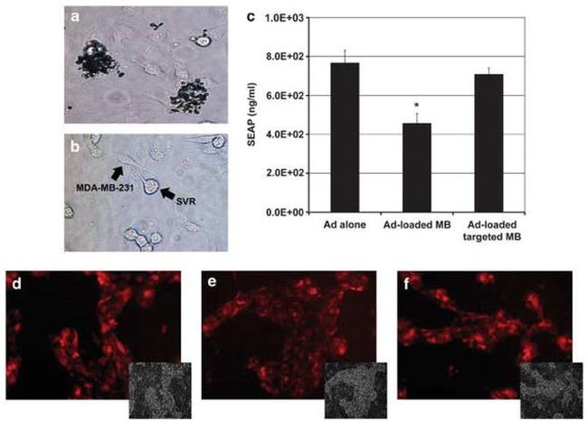Adenovirus Type 5 Hexon Antibody in Immunocytochemistry (ICC/IF)
