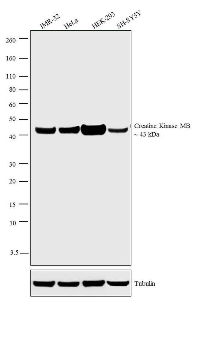 Creatine Kinase MB Antibody in Western Blot (WB)
