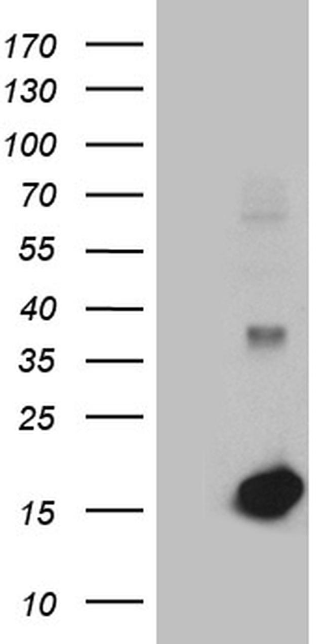 LGALS1 Antibody in Western Blot (WB)