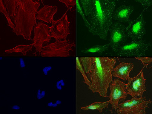 LGALS3 Antibody in Immunocytochemistry (ICC/IF)