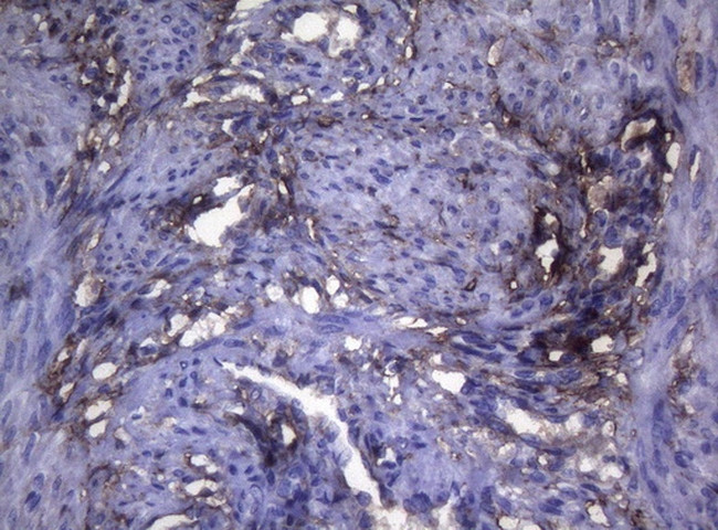 LGALS3 Antibody in Immunohistochemistry (Paraffin) (IHC (P))