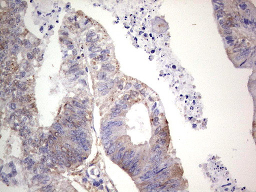 LGALS3 Antibody in Immunohistochemistry (Paraffin) (IHC (P))