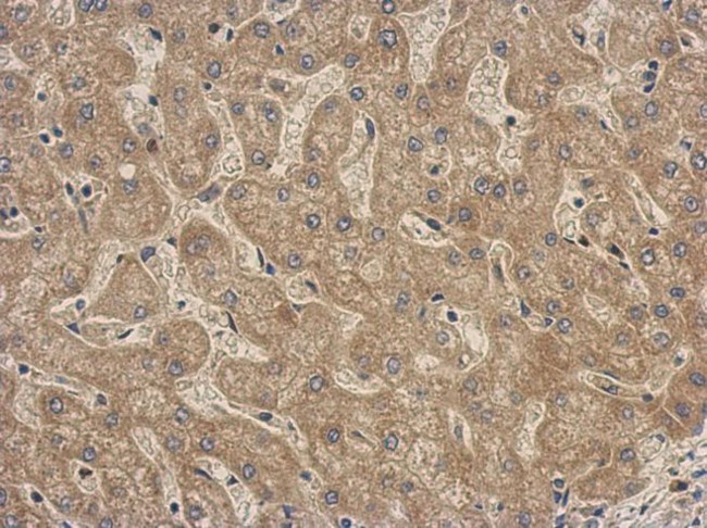 LGALS3BP Antibody in Immunohistochemistry (IHC)