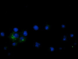 LGR5 Antibody in Immunocytochemistry (ICC/IF)