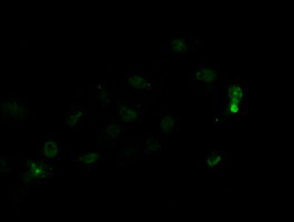 LGR5 Antibody in Immunocytochemistry (ICC/IF)