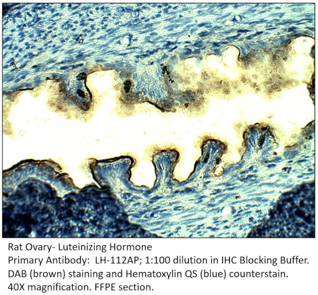 Luteinizing Hormone Antibody in Immunohistochemistry (IHC)