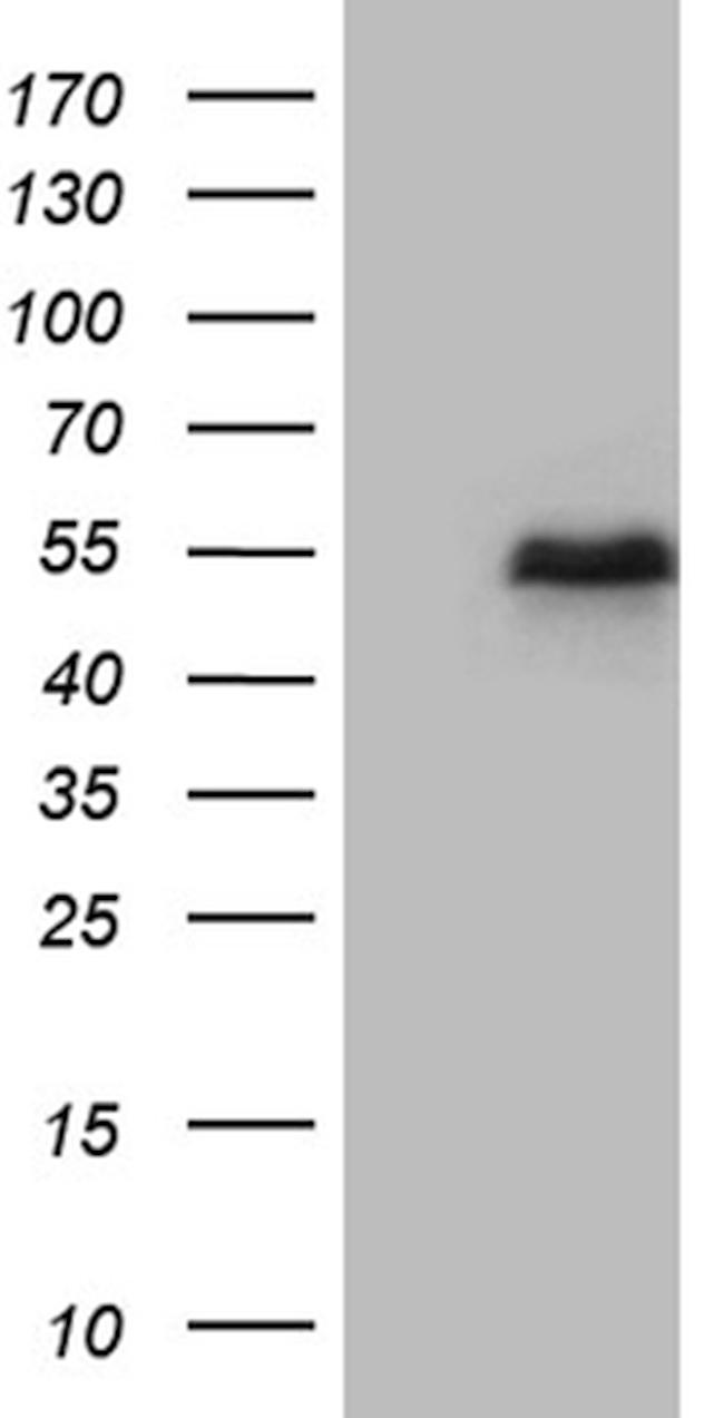 LHX2 Antibody in Western Blot (WB)