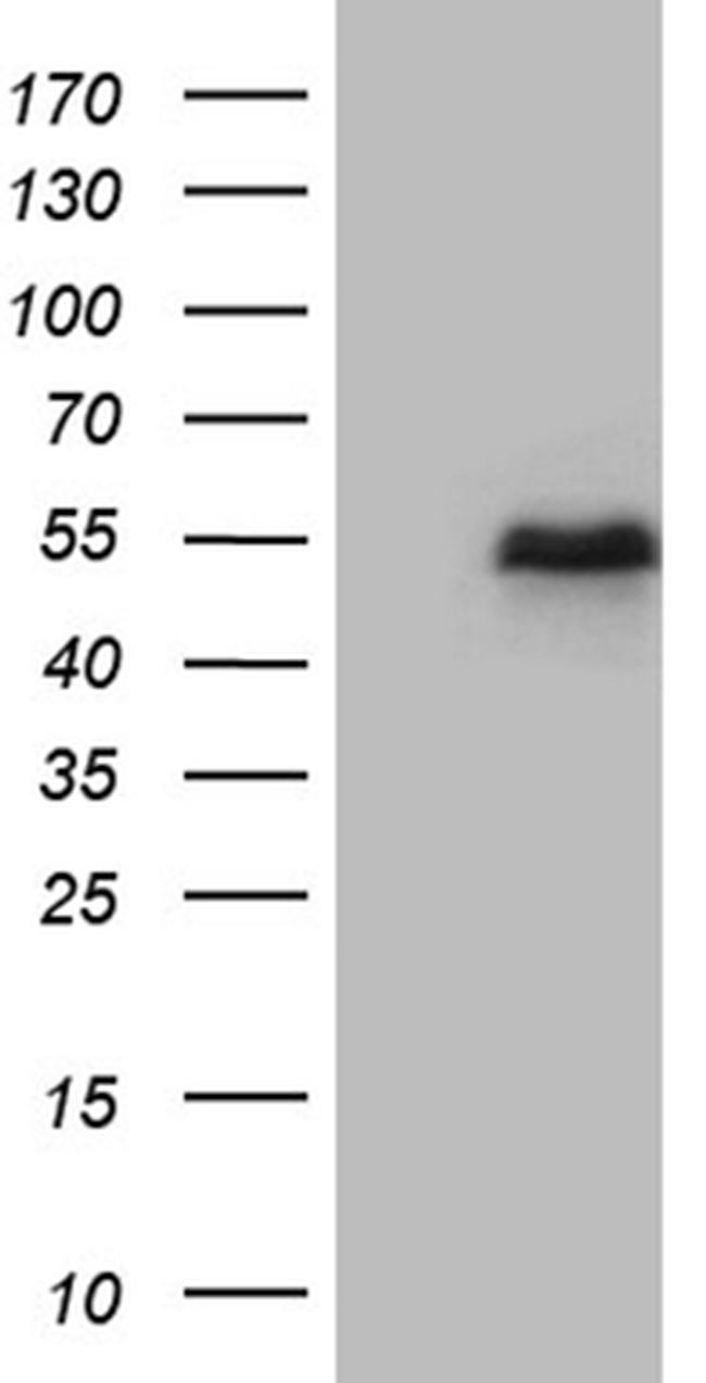 LHX2 Antibody in Western Blot (WB)
