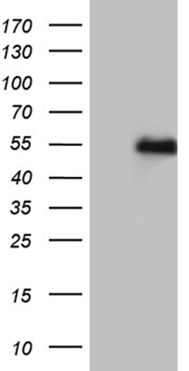 LHX2 Antibody in Western Blot (WB)