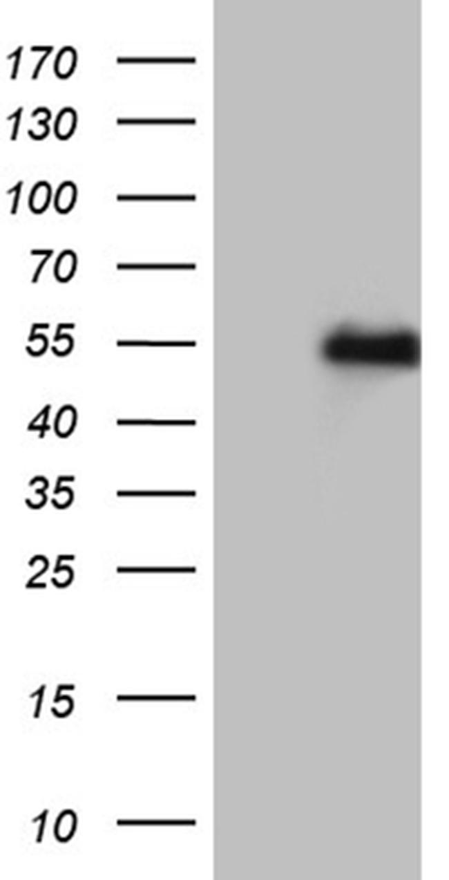 LHX2 Antibody in Western Blot (WB)