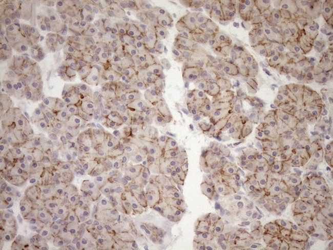 LIMA1 Antibody in Immunohistochemistry (Paraffin) (IHC (P))